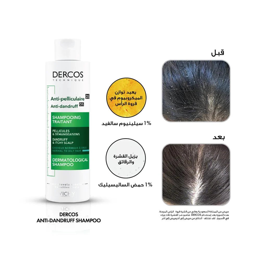 Vichy Dercos Anti Dandruff Dry Hair Shampoo 200ML