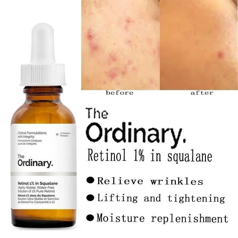 The Ordinary Retinol 0.2% in squalane 30 ml
