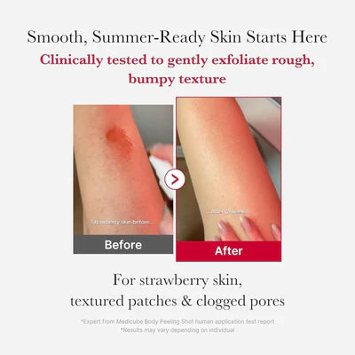 غسول بخاخ ميديكيوب الأحمر لتقشير الجسم – 110جم / Medicube Red Acne Peeling Shot