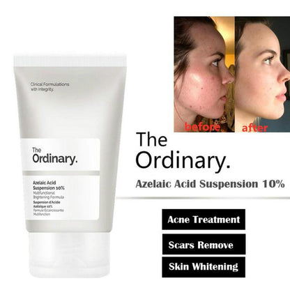 The Ordinary Azelaic Acid Suspension 10%, Formula for Uneven and Blemish-Prone Skin 30ml