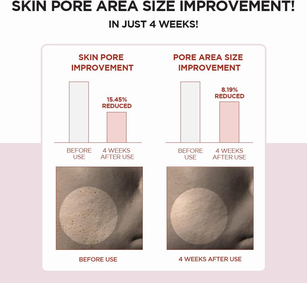 SKIN1004 Madagascar Centella Poremizing Clear Toner – 7.1 fl.oz (210ml) | Exfoliating Toner for Clogged Pores & Sensitive Skin