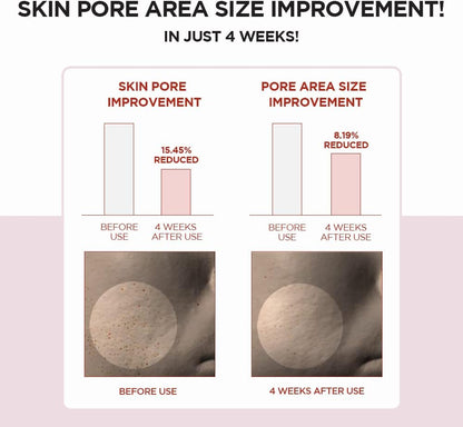 SKIN1004 Madagascar Centella Poremizing Clear Toner – 7.1 fl.oz (210ml) | Exfoliating Toner for Clogged Pores & Sensitive Skin