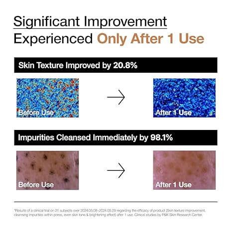 ANUA RICE ENZYME BRIGHTENING CLEANSING POWDER, Rice Mask, Ceramide, Gentle Face Wash for Brightening, Radiant Skin