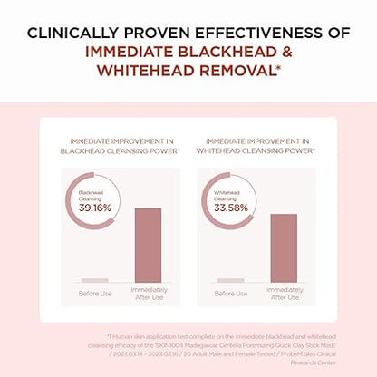 قناع الطين السريع المسامي من SKIN1004 بخلاصة سنتيلا مدغشقر - 27 جم