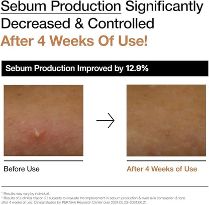 ANUA Rice 70 Glow Milky Toner, for Glass Skin, Rice Water, Niacinamide, Ceramides, Panthenol