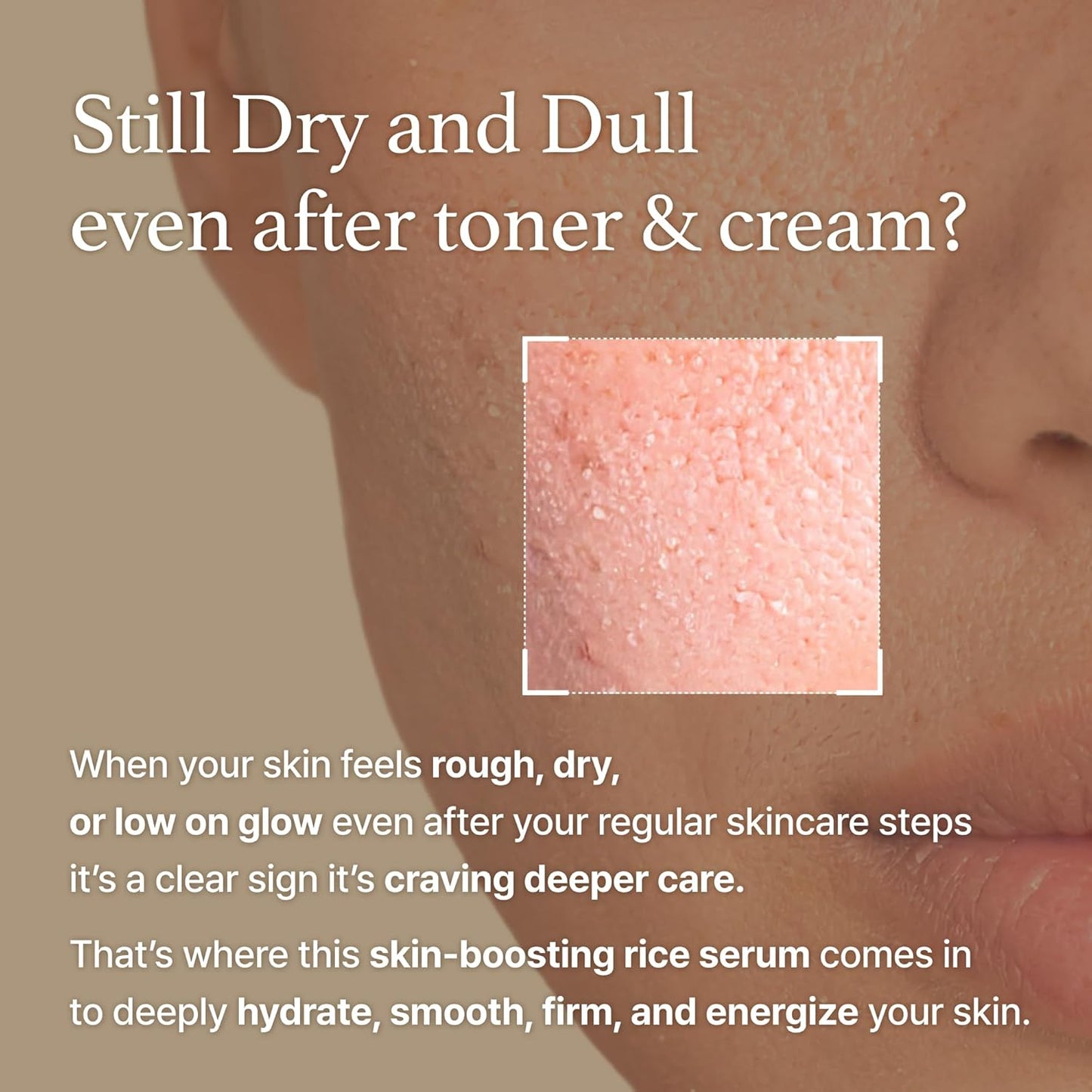 I'm from Rice Serum.