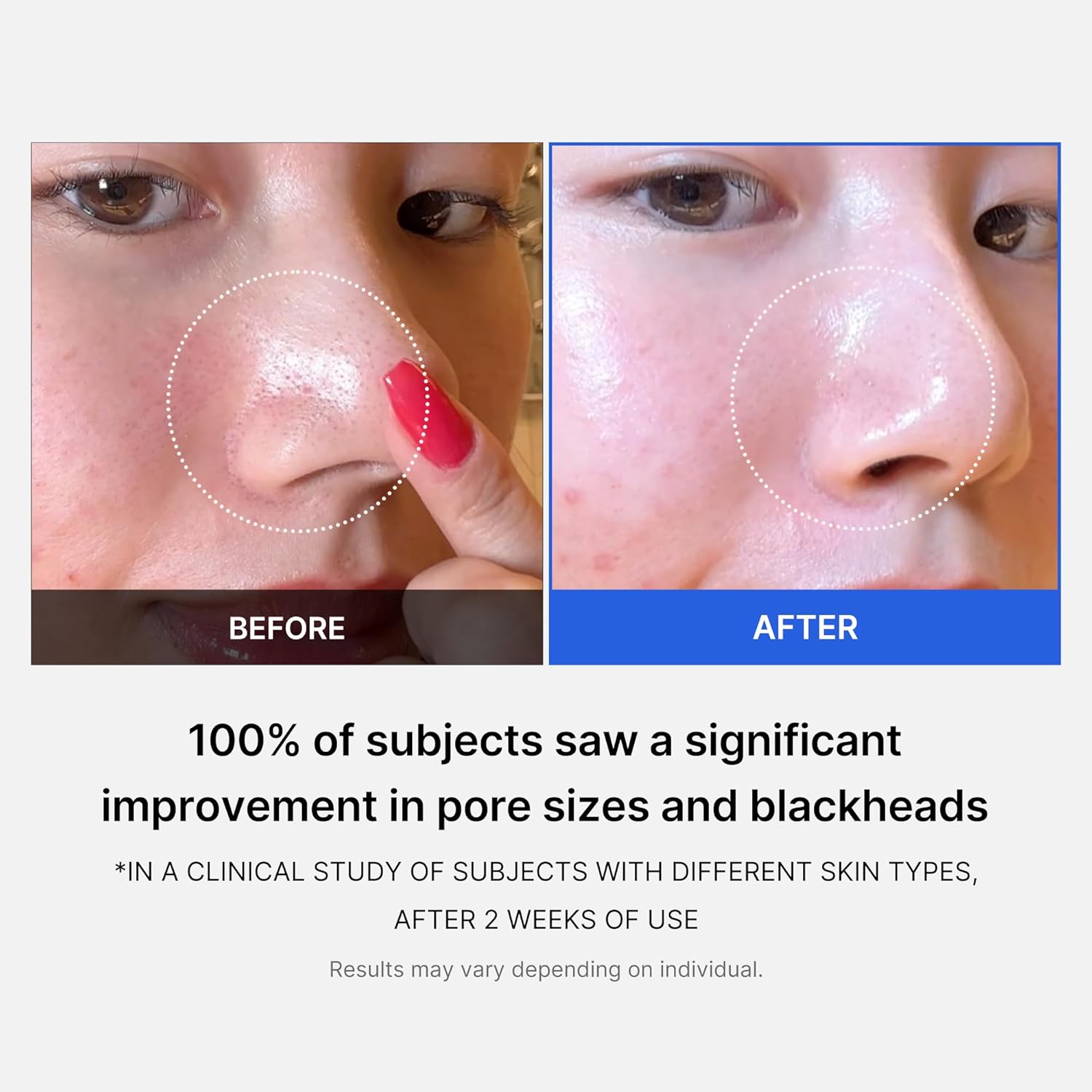 Medicube Zero Pore Pads - 70 pads / Oman