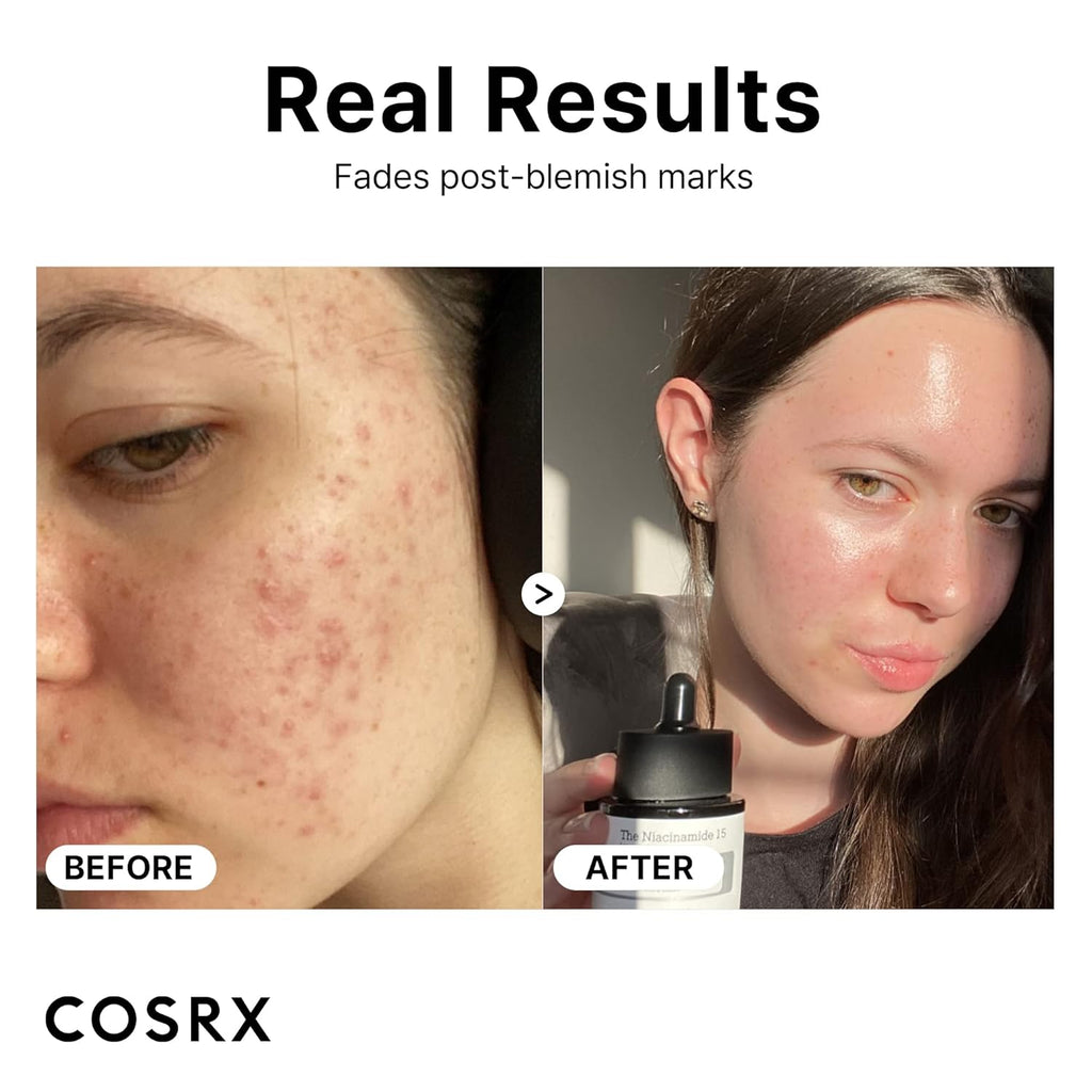 COSRX The Niacinamide 15 [Serum] Acetyl Glucosamine + Zinc PCA 20 ml