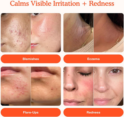 Tower 28 SOS Daily Rescue Facial Spray