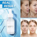 The Ordinary Niacinamide 10% + Zinc 1% 30 ml