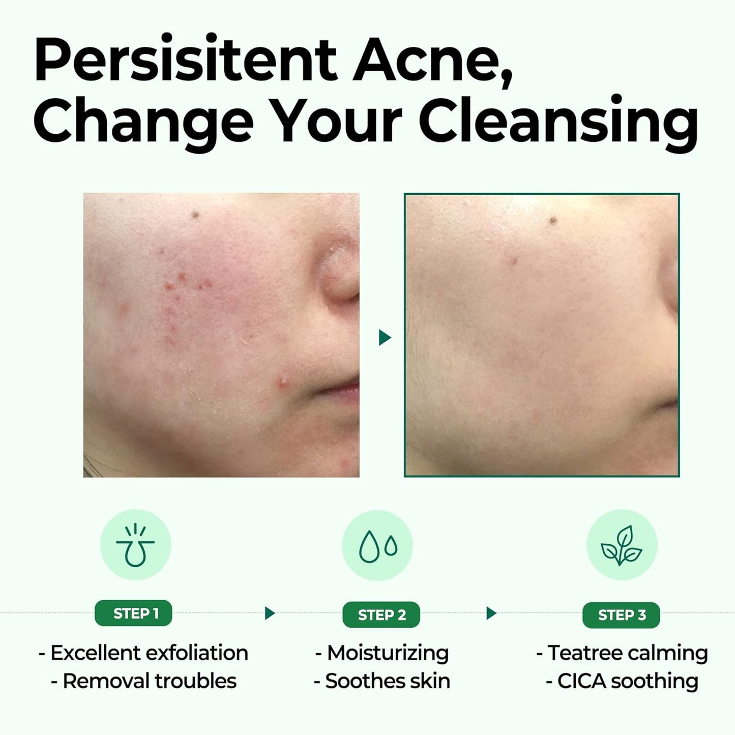 SOME BY MI AHA.BHA.PHA 30 Days Miracle Cleansing Bar 106 g