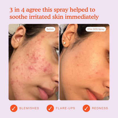 Tower 28 SOS Daily Rescue Facial Spray