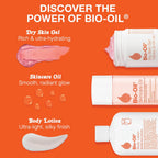 Bio-Oil Moisturizing Body Lotion for Dry Skin, Ultra-Lightweight High-Oil Hydration, with Jojoba, Rosehip, Shea, and Hyaluronic Acid, 5.9 Oz