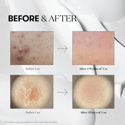 سيكا ريدل شوت ١٠٠ من في تي كوزماتيكس، سيروم سبيكيول مايكرونيدلينج للعناية بالمسام والتقشير، إكسوزوم، عشبة سنتيلا آسياتيكا للبشرة الزجاجية، ملمس البشرة، معزز البشرة السائل الكوري