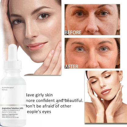 The Ordinary  Argireline Solution 10%  30 ml