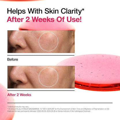 ANUA Niacinamide 10 + TXA 4 Serum, Hyaluronic Acid, Tranexamic acid, Vitamin B12