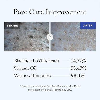 medicube Zero Pore Blackhead Mud Facial Mask