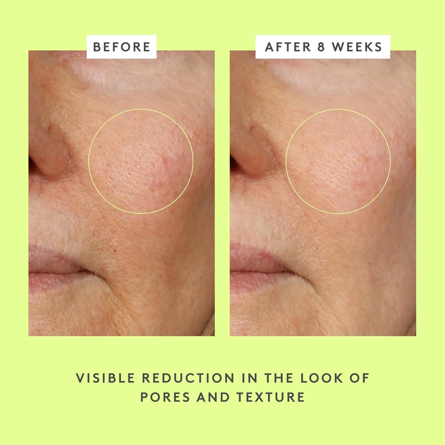 سيروم Drunk Elephant TLC Framboos Glycolic - سيروم مقشر AHA - عناية طبية نظيفة بالبشرة - خالٍ من القسوة - تم اختباره من قبل أطباء الجلدية - خالٍ من الزيوت العطرية والسيليكون والعطور 