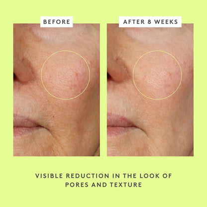 سيروم Drunk Elephant TLC Framboos Glycolic - سيروم مقشر AHA - عناية طبية نظيفة بالبشرة - خالٍ من القسوة - تم اختباره من قبل أطباء الجلدية - خالٍ من الزيوت العطرية والسيليكون والعطور 