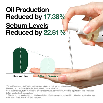 زيت تنظيف أنوا هارتليف للتحكم في المسام، منظف زيتي للوجه، مزيل للرؤوس السوداء من المكياج، للعناية بالبشرة الكورية 6.76 أونصة سائلة (200 مل) (أصلي) 