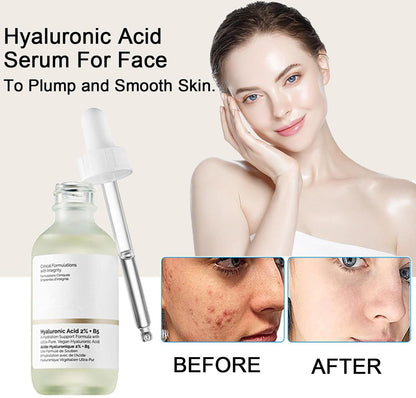 The Ordinary Hyaluronic Acid 2% + B5 30 ml