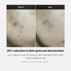 Medicube Deep Vita C Serum 2.0 || 14.5% Pure Vitamin C (10g * 3 bottles)