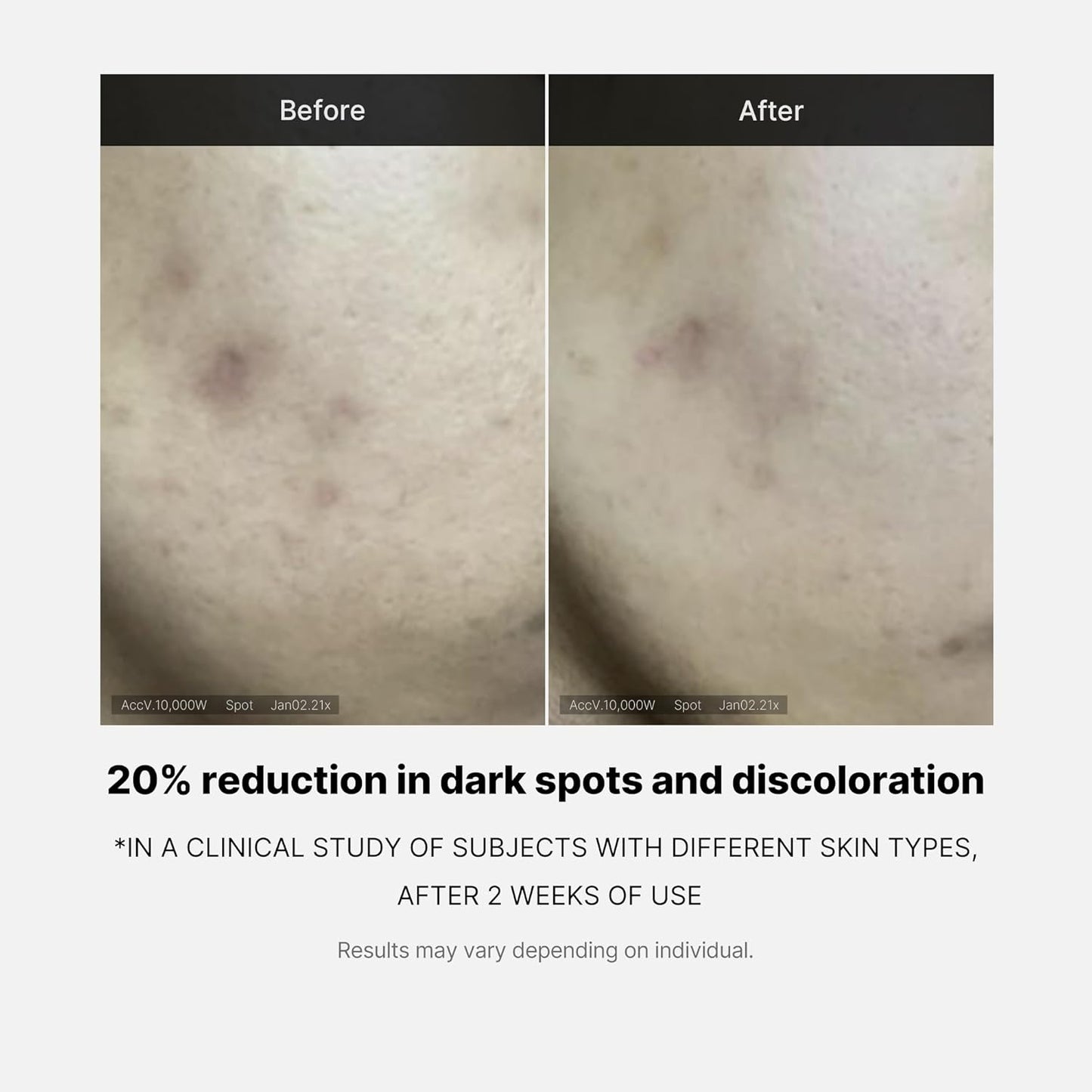 Medicube Deep Vita C Serum 2.0 || 14.5% Pure Vitamin C (10g * 3 bottles)