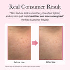 Arencia PDRN Booster Shot,