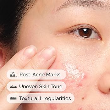 محلول الصبار 2% + NAG 2% من ذا أورديناري، 30 مل