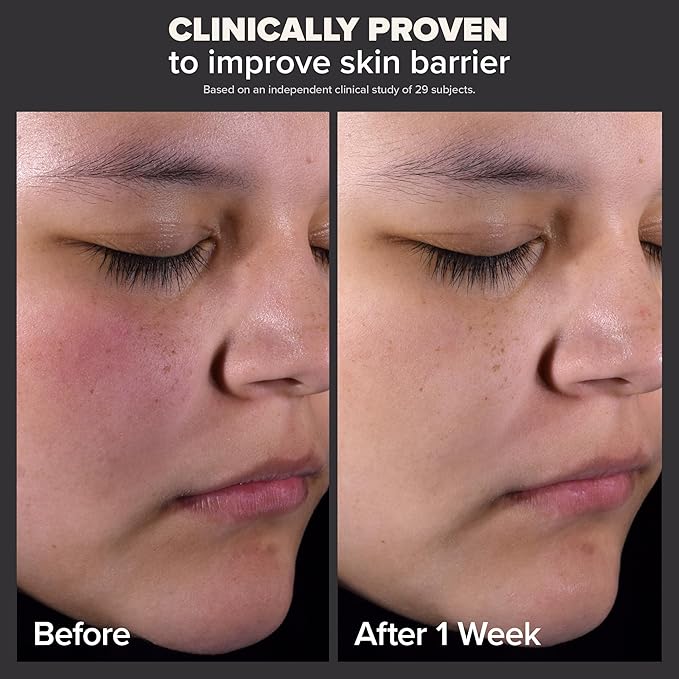 PAULA’S CHOICE EXFOLIATE 2% BHA Liquid Exfoliant Salicylic Acid. 30ml & 118ml