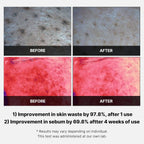 Medicube Red Succinic Acid Panthenol Facial Peeling Pads