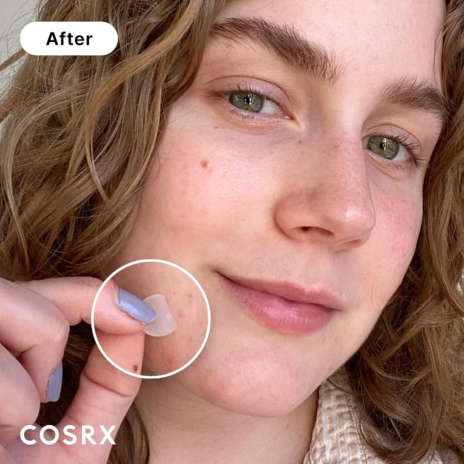 COSRX Acne Pimple Master Patch (A.D.F. Hydrocolloid Dressing) 24 Patches/Pouch