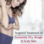 Eucerin Roughness Relief Spot Treatment 71 g