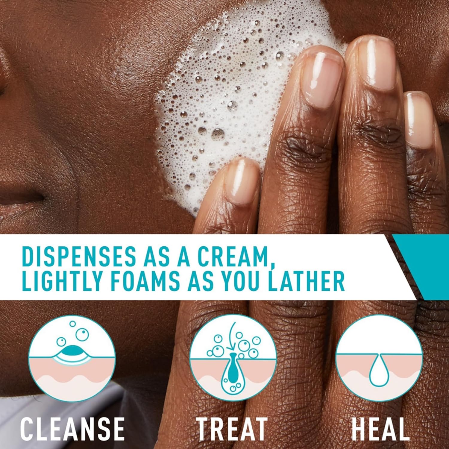 CeraVe Acne Foaming Cream Cleanser 148/150 ml