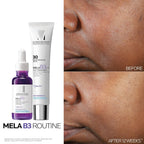 La Roche-Posay Mela B3 Serum 30ml