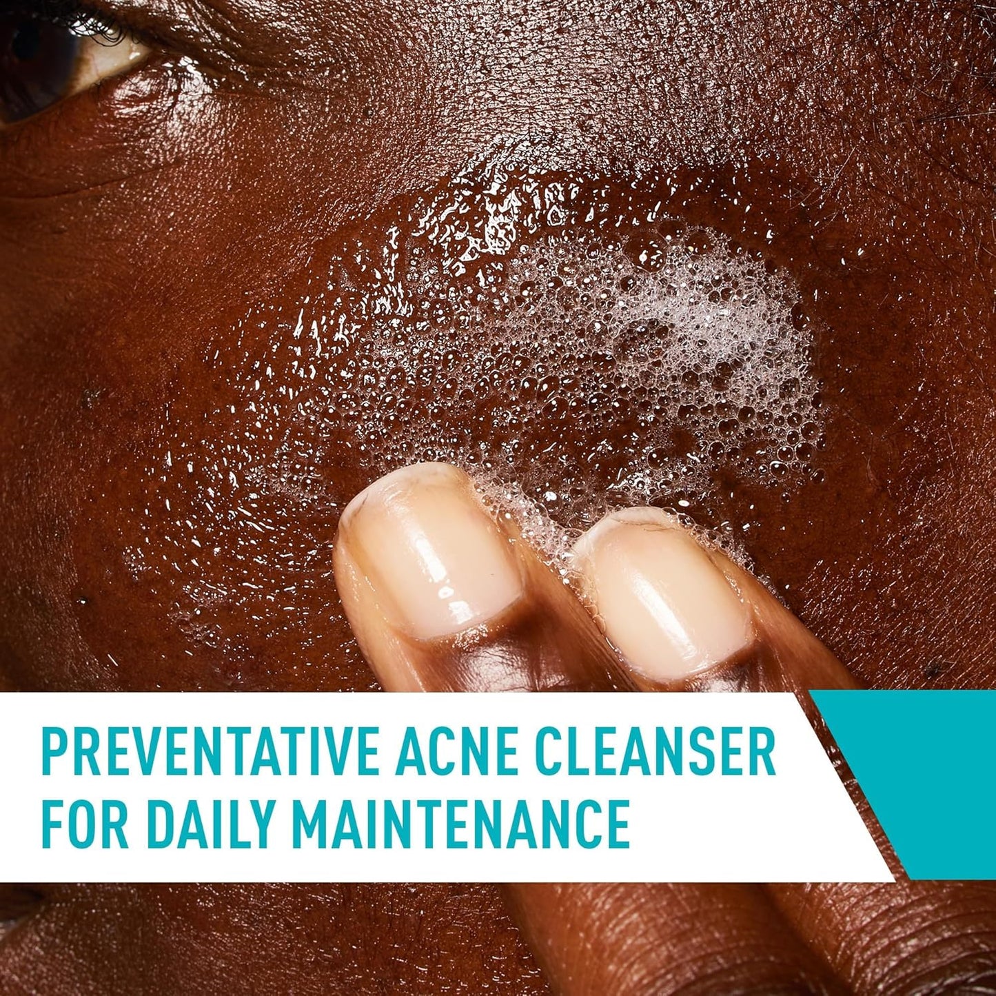 CeraVe Acne Control Cleanser | With 2% Salicylic Acid & Niacinamide
