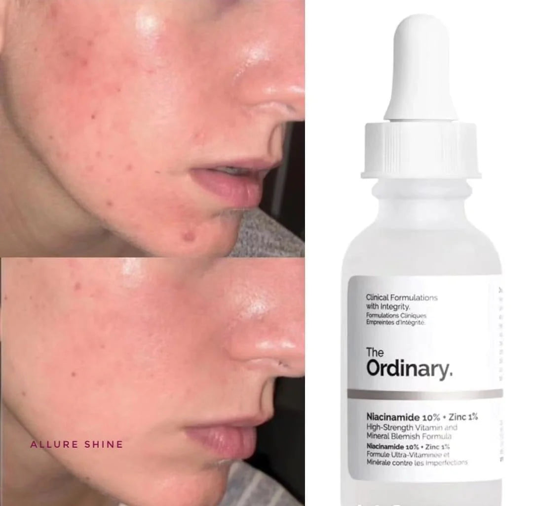 The Ordinary  Niacinamide 10% + Zinc 1%  30 ml