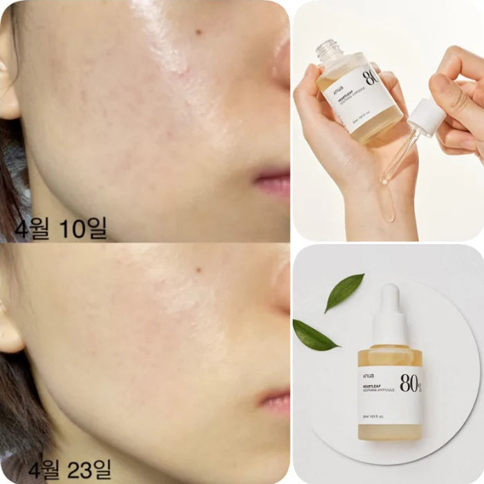 Anua Heartleaf 80% Moisture Soothing Ampoule 30ml