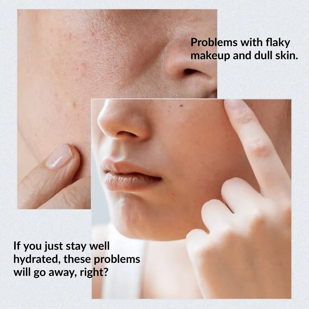 Anua, Birch 70 Moisture, Boosting Serum 70% - 30ml