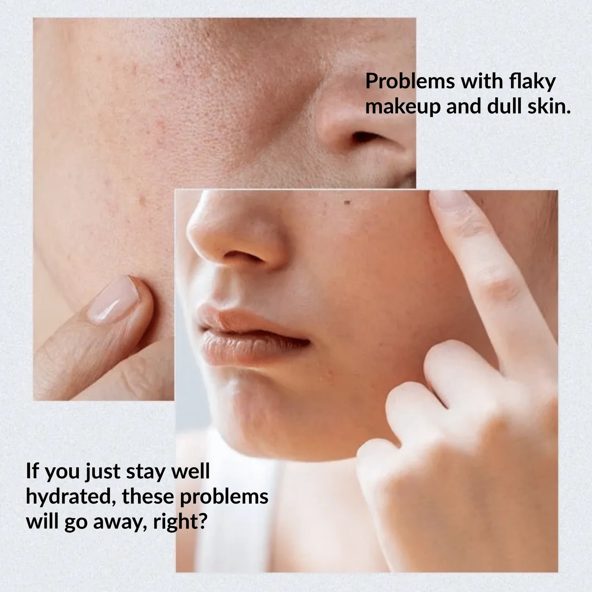 Anua, Birch 70 Moisture, Boosting Serum 70% - 30ml