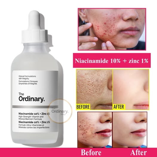 The Ordinary Niacinamide 10% + Zinc 1% 30 ml