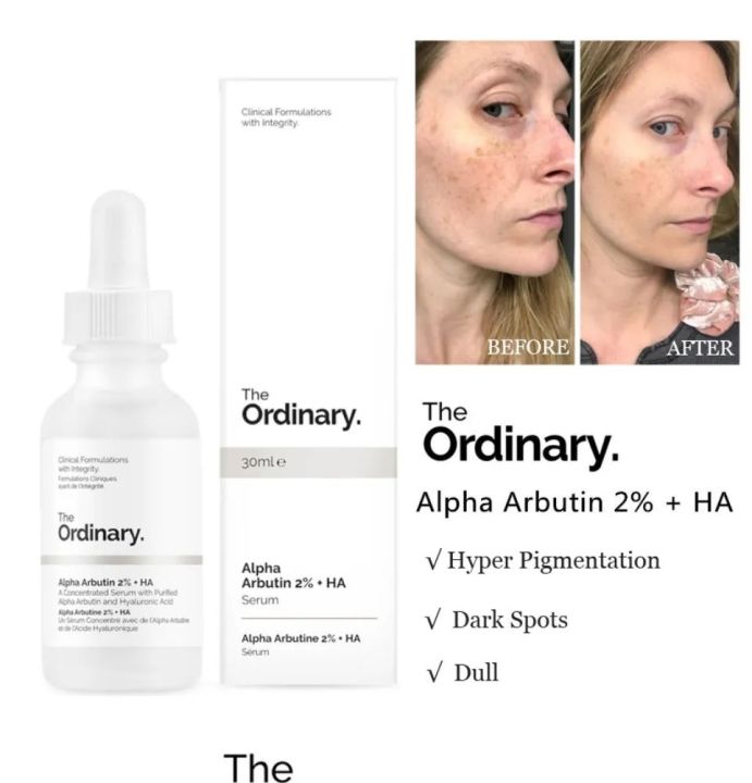 The Ordinary Alpha Arbutin 2% + HA 30 ml