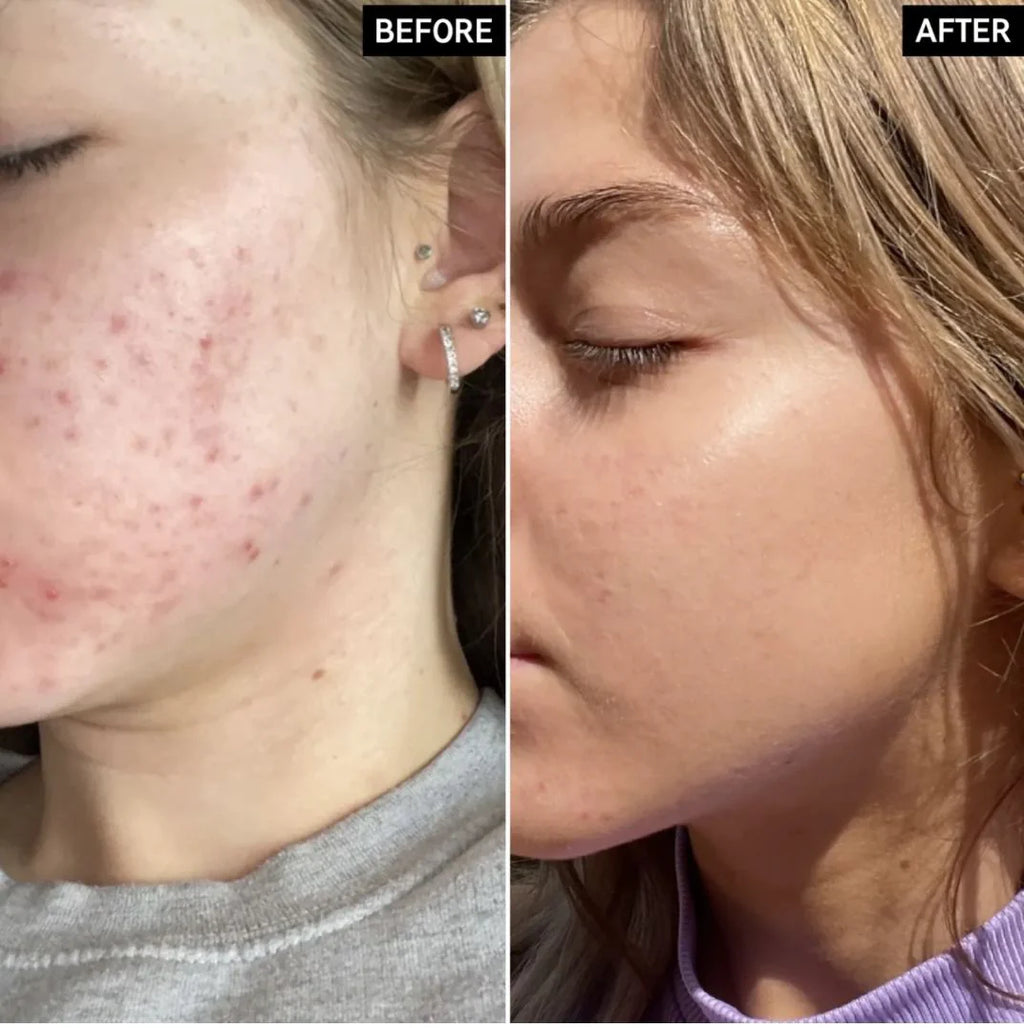 The Ordinary  Alpha Arbutin2% + HA  30 ml
