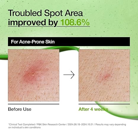 Anua Azelaic Acid 10% + Hyaluron Redness Soothing Serum