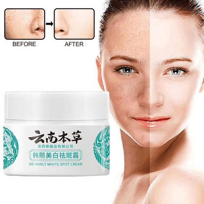 DR HANCHY WHITE 
SPOT CREAM
moistursing cream,skin
care whitening cream 
and powder. 20g