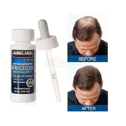 Kirkland Signature,6 Months-Minoxidil 5% Topical Solution Extra Strength Hair Regrowth Treatment for Men【 Dropper Applicator and Pump Mist Sprayer Included】Hair Loss Regrowth -Total 12 Oz