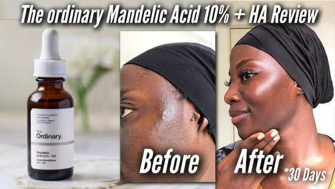 The Ordinary Mandelic Acid 10% + HA • 30ml