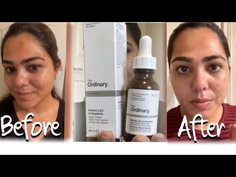The Ordinary Retinol 0.5% in Squalane