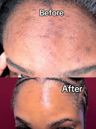 Anua Niacinamide Serum & Oil Cleanser Set – Brighten, Balance & Cleanse