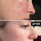 The Ordinary Granactive Retinoid 2% in Squalane 30 ml